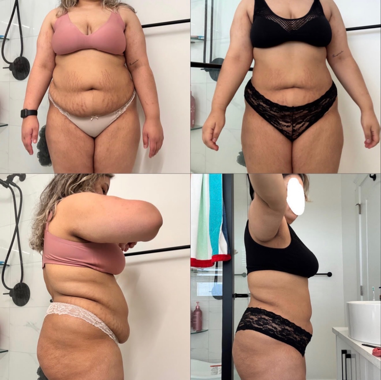 Before and after transformation result after 6 weeks — member 3