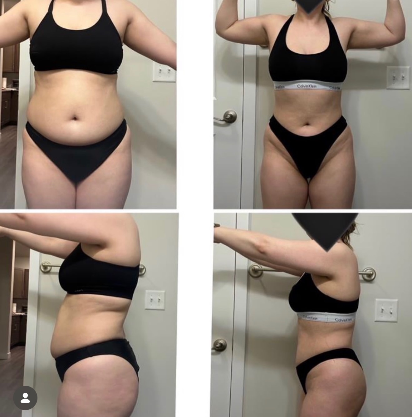 Before and after transformation result after 6 weeks — member 9