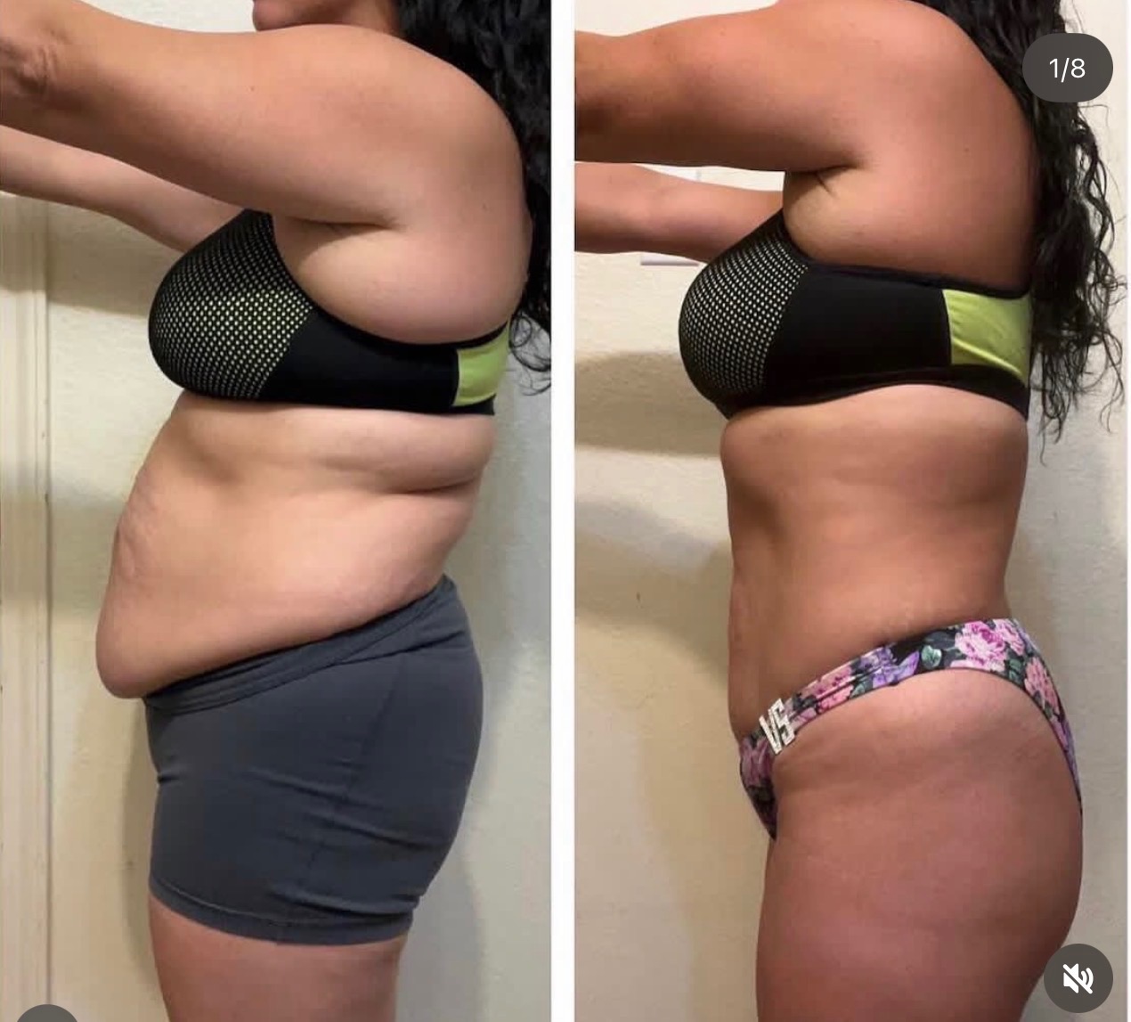 Before and after transformation result after 6 weeks — member 10