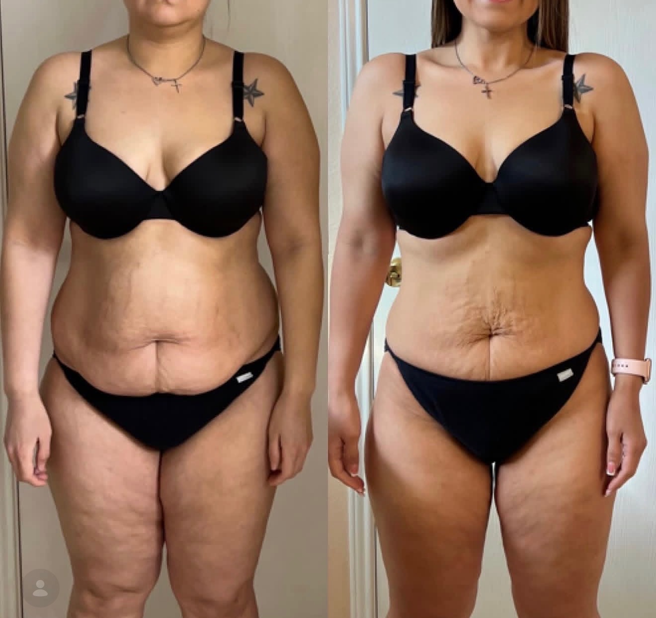 Before and after transformation result after 6 weeks — member 8