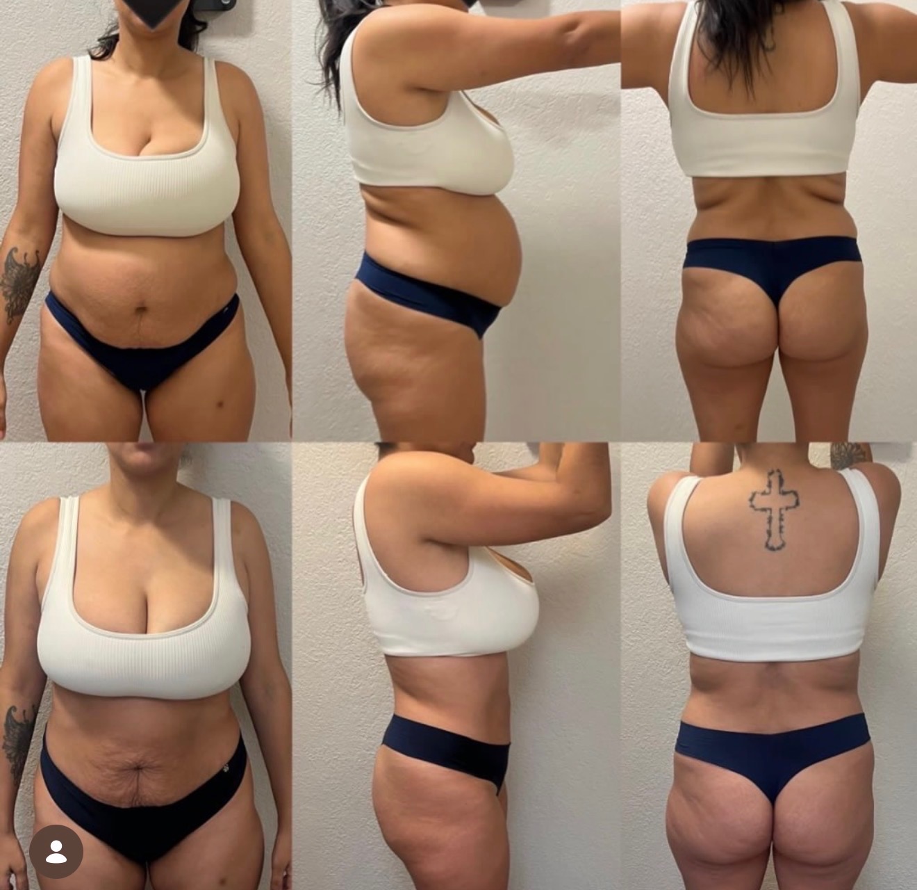 Before and after transformation result after 6 weeks — member 5